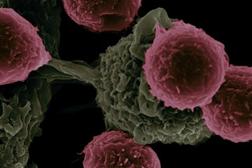 DS Journal of Cancer Research